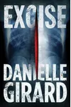 Excise