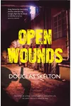 Open Wounds