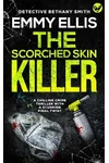 The Scorched Skin Killer / How Skin Burns