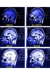 Brain Movies, Volume 6