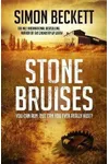 Stone Bruises